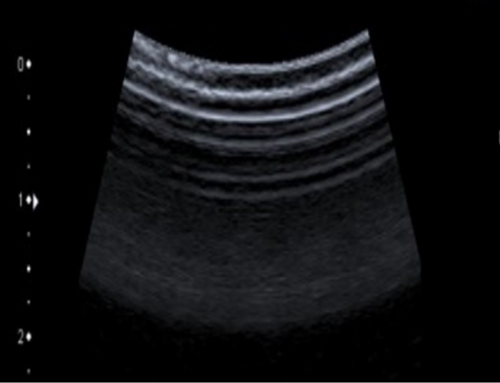 Seismic Imaging Techniques Adapted to Medical Ultrasound